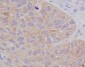 Anti-STAT2 Rabbit Monoclonal Antibody